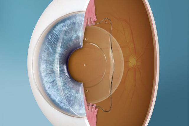 Medifocus ICL