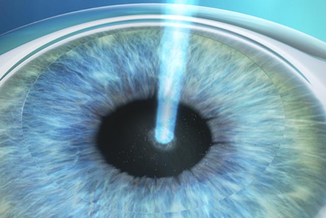 Medifocus PRK